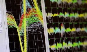 Brain Machine Interfaces BMI